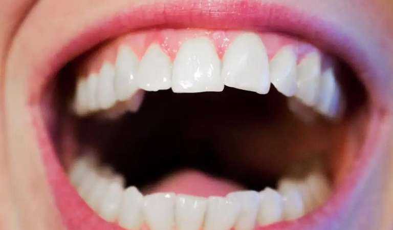 Bezpłatne badanie w kierunku nowotworu jamy ustnej Rzeszów