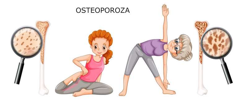 Bezpłatne badania profilaktyczne na obecność osteoporozy (stacjonarnie Kraków)